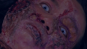 Zombie nákaza a její projevy na kůži.