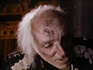 Asi zlá vyrážka.